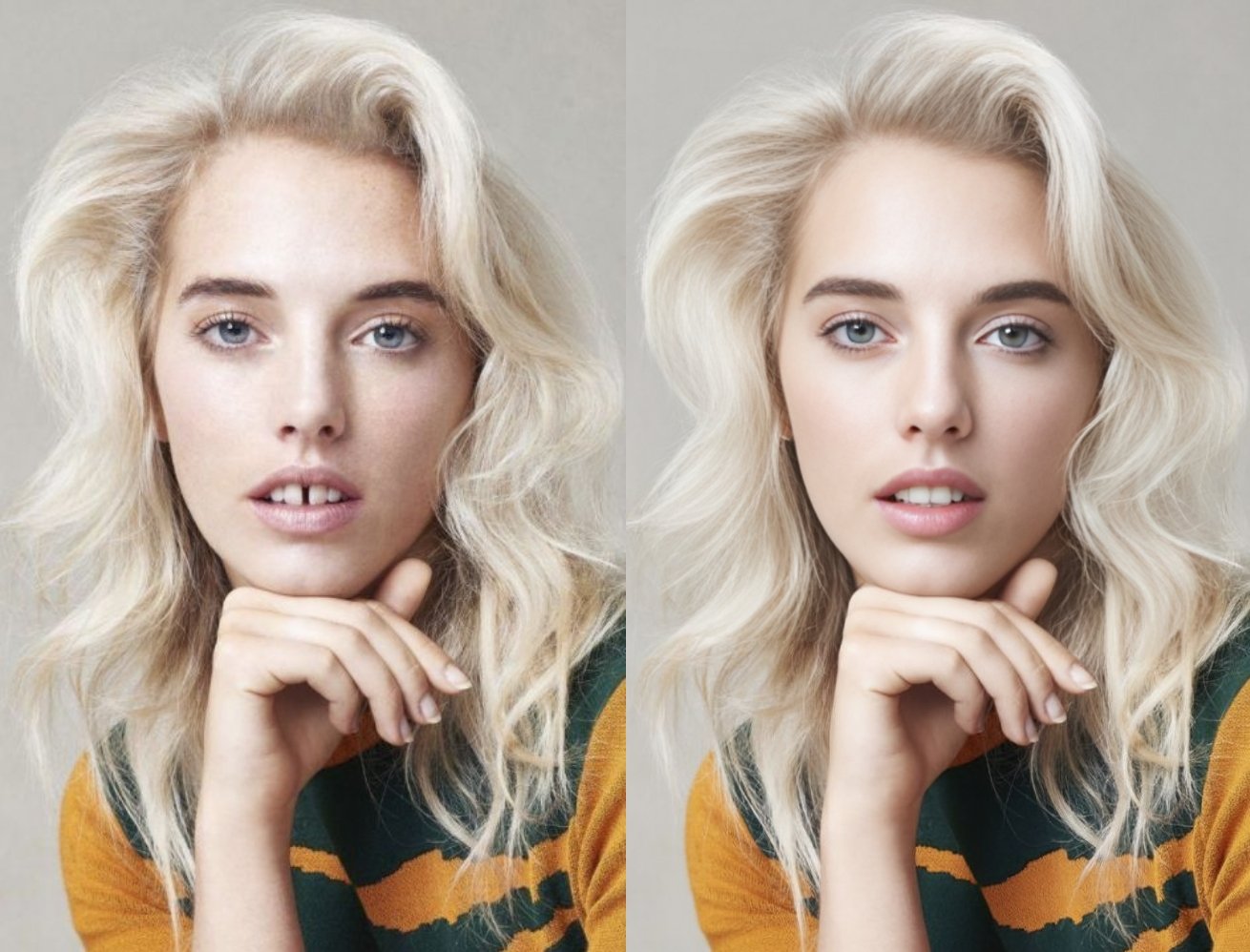 写真の笑顔を美しく — ホワイトニング＆歯並び補正をAIで